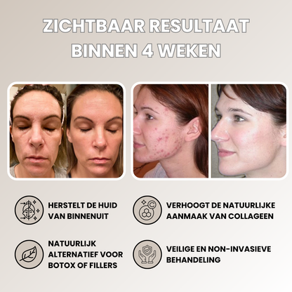 Vitalwave Rood Licht LED Gezichtsmasker